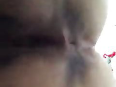 Amateur Anal Hairy 